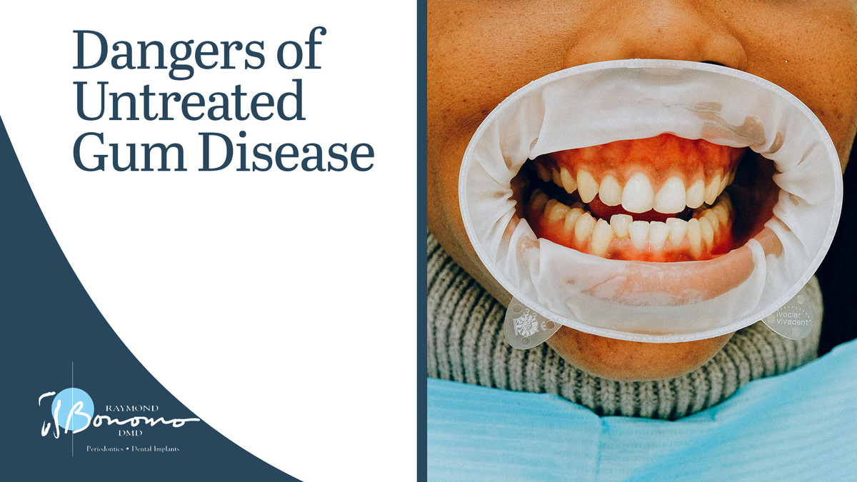 Dangers of Untreated Gum Disease